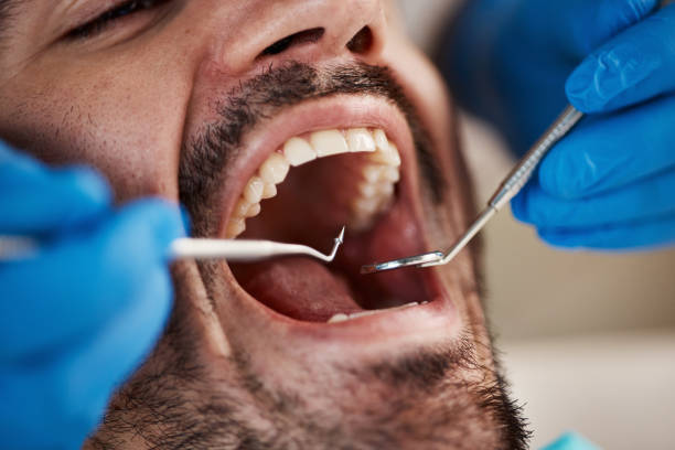 Best Pediatric Emergency Dentist in Pittsboro, NC